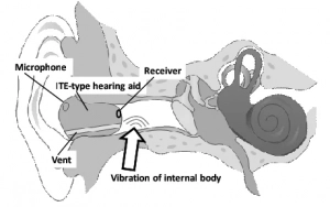 ปัญหาพิมพ์หู Vent รูระบายอากาศ Cross-section view of the ear canal with ITE type of hearing aid